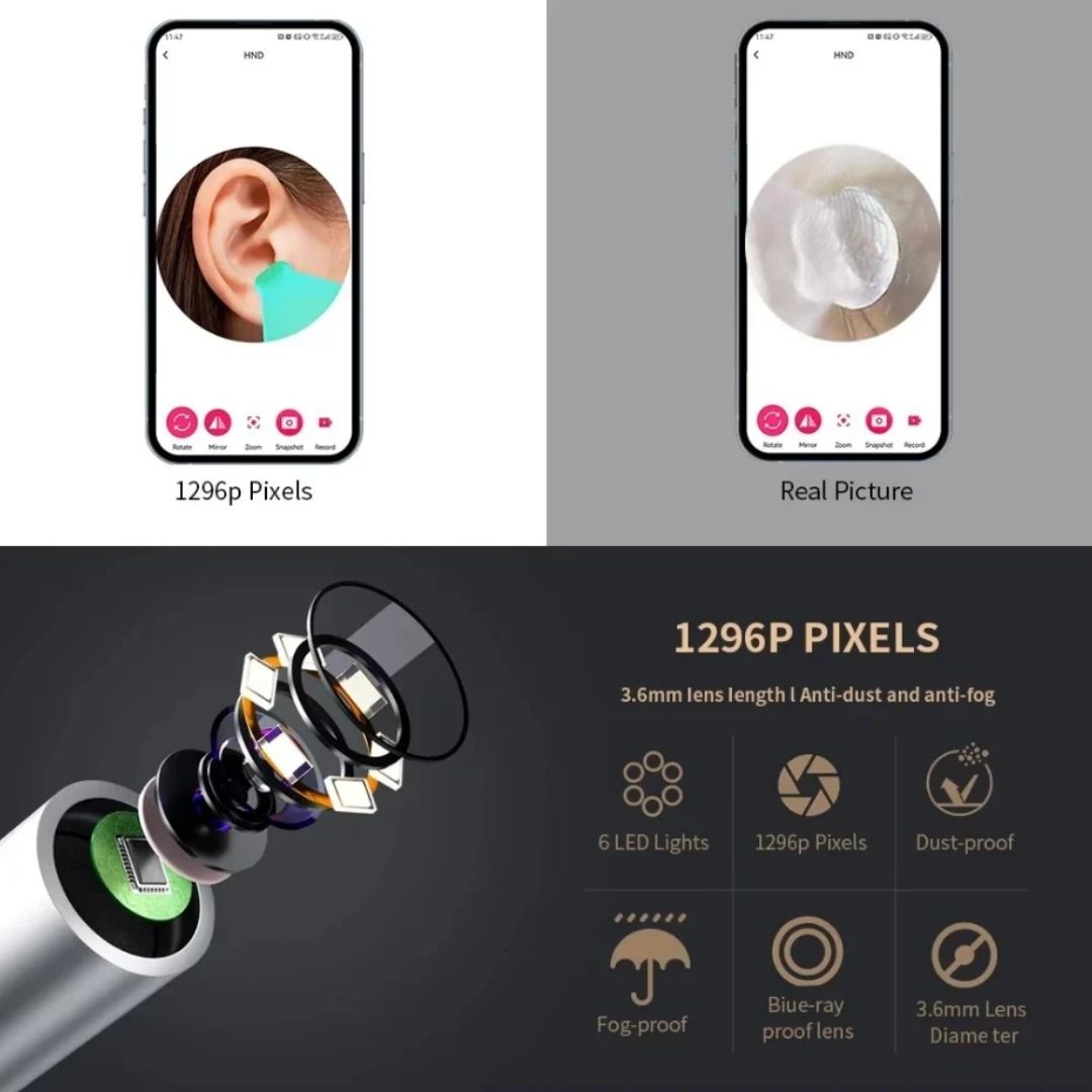 Kameralı Akıllı Görsel Kulak Temizleyici Otoskop 6 Ledli Wifi USB-C Bağlantılı Kameralı Akıllı Görsel Kulak Temizleyici Otoskop 6 Ledli Wifi USB-C Bağlantılı